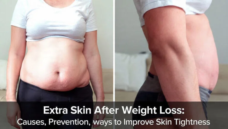 Is Extra Skin After Weight Loss Inevitable? Here’s What the Science Says
